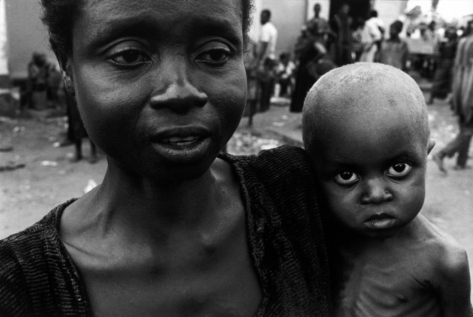 یک زن پناهنده ایبویی به همراه فرزند خود در بازار. هر دوی آنها از سوء تغذیه رنج می‌برند. نیجریه، بیافرا، ۱۹۷۰.